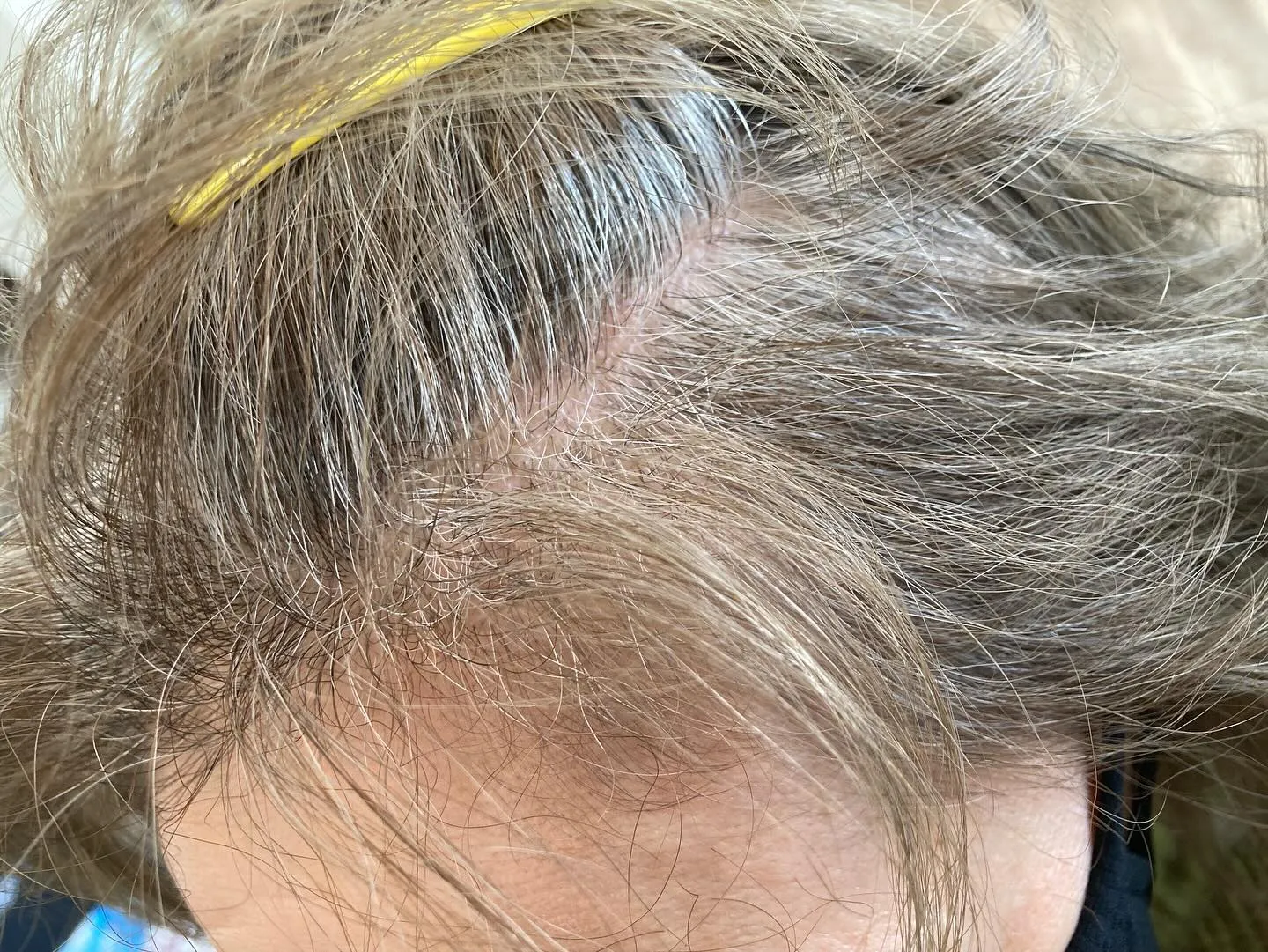 ファッションカラーで白髪染め✨